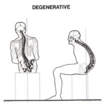 spinal stress sitting