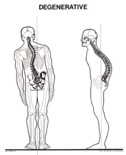 spinal stress standing